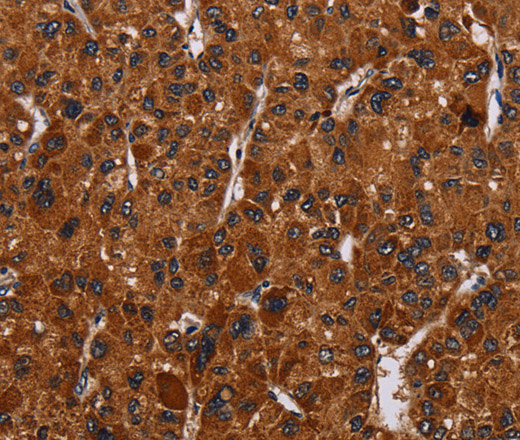 RTN4R Polyclonal Antibody (E-AB-16652)