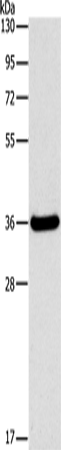 FGL1 Polyclonal Antibody (E-AB-14080)
