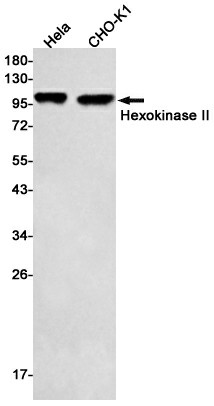 Recombinant Hexokinase II Monoclonal Antibody (E-AB-81474)
