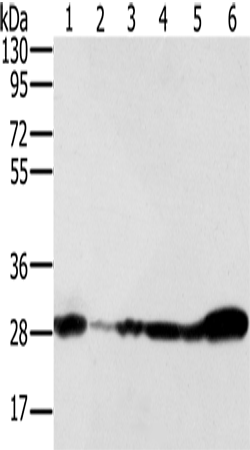 NDUFS3 Polyclonal Antibody (E-AB-15242)