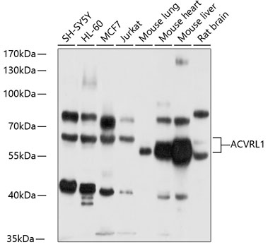 ACVRL1 Polyclonal Antibody (E-AB-91952)