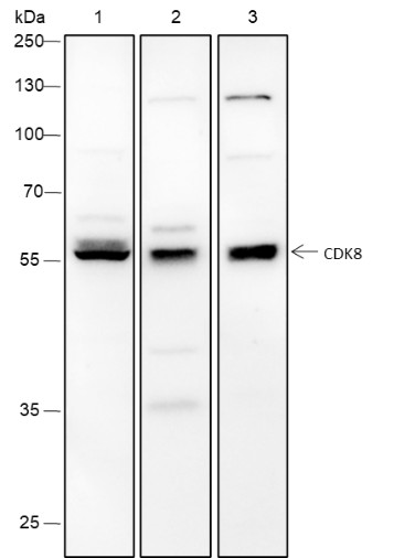 Recombinant CDK8 Monoclonal Antibody (AN301488L)