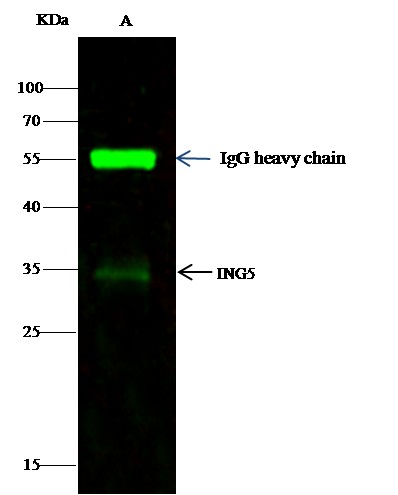 Recombinant ING5 Monoclonal Antibody (AN300274P)