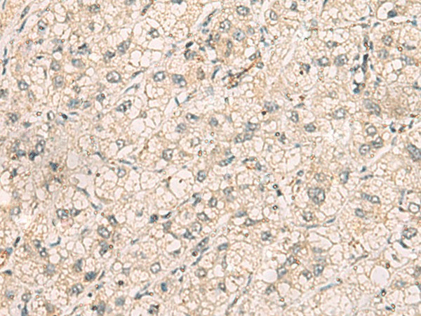 TTLL5 Polyclonal Antibody (E-AB-19211)