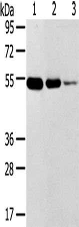 TMPRSS11F Polyclonal Antibody (E-AB-13740)