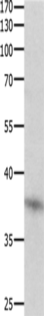 DUSP12 Polyclonal Antibody (E-AB-10309)