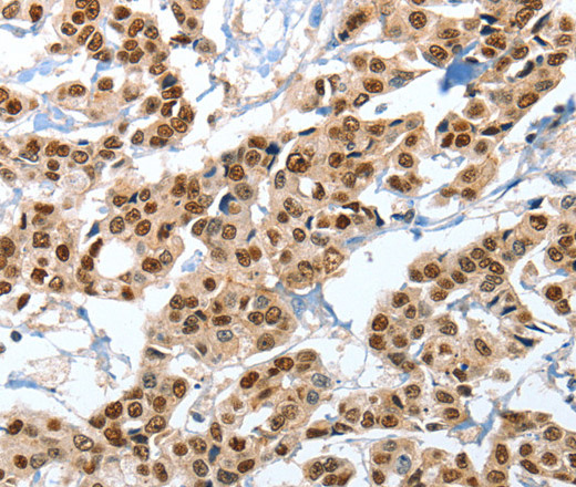 ANXA10 Polyclonal Antibody (E-AB-14571)