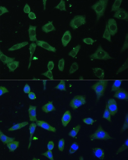 EIF3D Polyclonal Antibody (E-AB-63830)