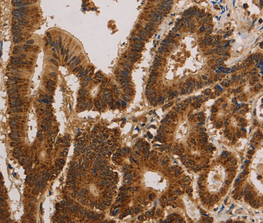 CSNK2B Polyclonal Antibody (E-AB-15553)