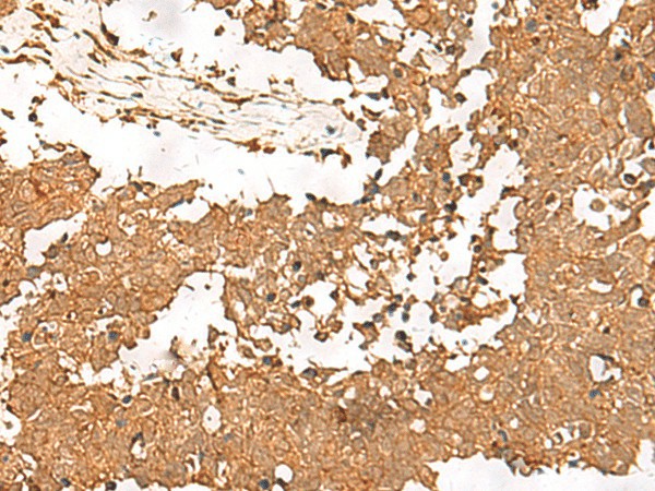 SMOC1 Polyclonal Antibody (E-AB-52748)