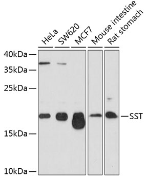 SST Polyclonal Antibody (E-AB-63947)
