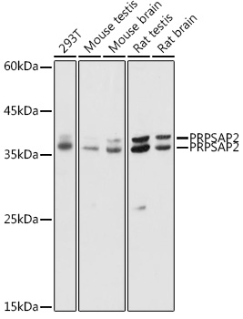 PRPSAP2 Polyclonal Antibody (E-AB-91254)