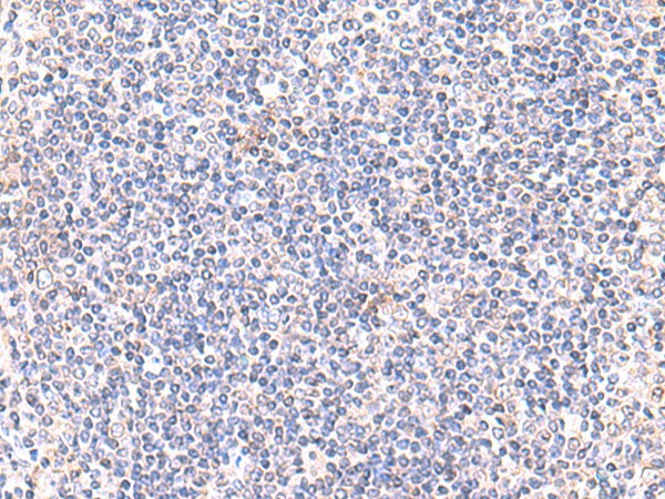 IFT57 Polyclonal Antibody (E-AB-52949)