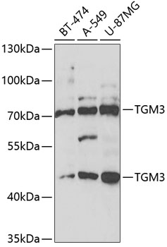 TGM3 Polyclonal Antibody (E-AB-67713)