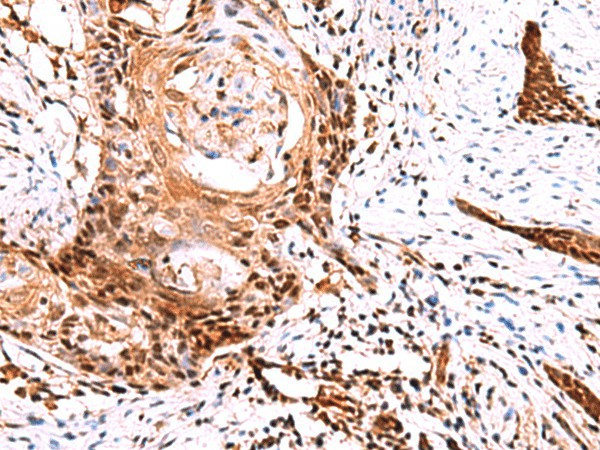 TSEN2 Polyclonal Antibody (E-AB-19052)
