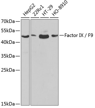 Factor IX / F9 Polyclonal Antibody (E-AB-60352)