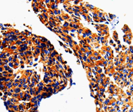 ADD1 Polyclonal Antibody (E-AB-10034)