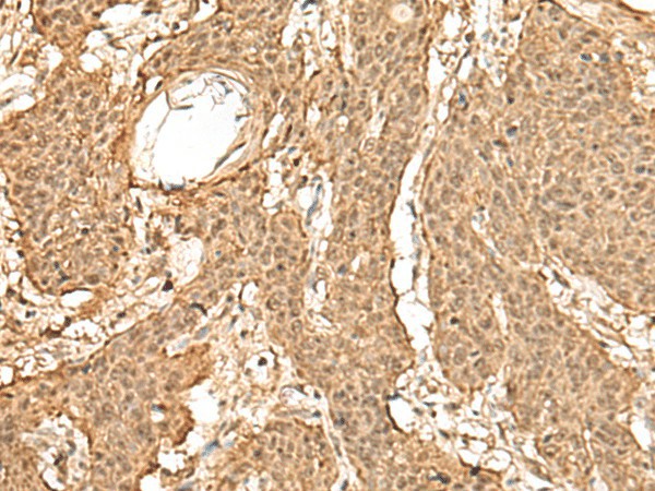 TIPRL Polyclonal Antibody (E-AB-18787)