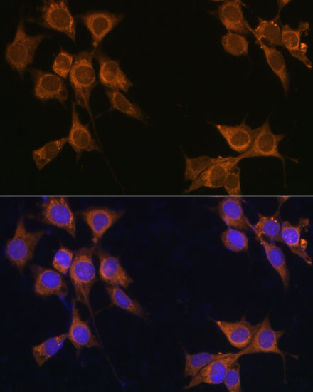 (KO Validated) CD133 Polyclonal Antibody (E-AB-64309)