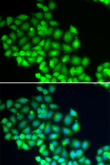 ERCC2 Polyclonal Antibody (E-AB-61805)