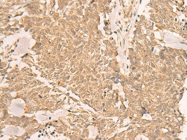 IL1RAPL2 Polyclonal Antibody (E-AB-18107)
