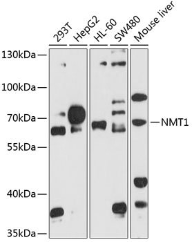 NMT1 Polyclonal Antibody (E-AB-68004)