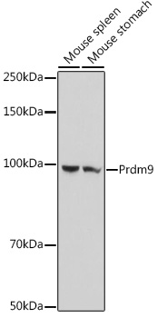Prdm9 Polyclonal Antibody (E-AB-92241)