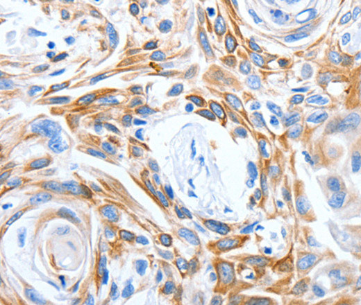 LRIG3 Polyclonal Antibody (E-AB-12545)