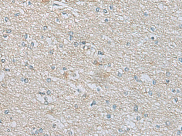 CDH12 Polyclonal Antibody (E-AB-19682)