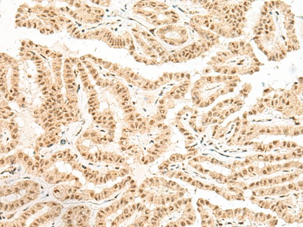 BICRA Polyclonal Antibody (E-AB-18004)