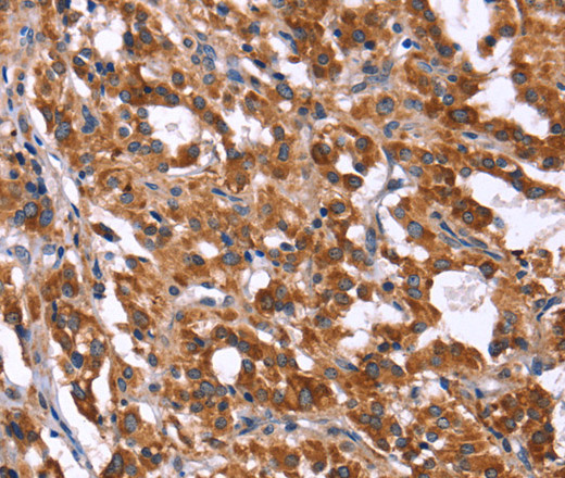 HACE1 Polyclonal Antibody (E-AB-13286)