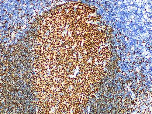 BOB.1 Monoclonal Antibody (ELAB6111-M)