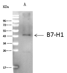 PD-L1/B7-H1/CD274 Monoclonal Antibody (AN200150P)