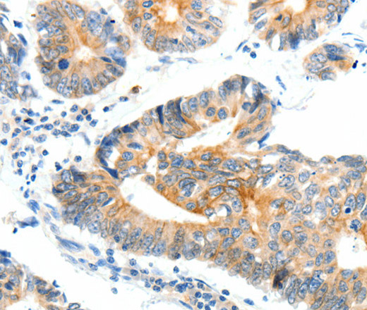 NTRK1 Polyclonal Antibody (E-AB-12668)