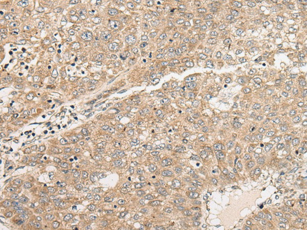 C1orf101 Polyclonal Antibody (E-AB-52492)
