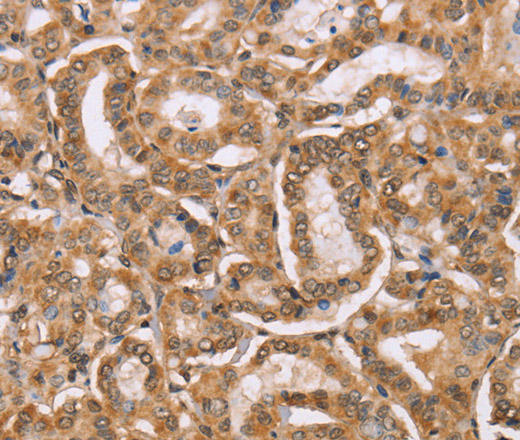 BGLAP Polyclonal Antibody (E-AB-13089)
