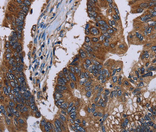 CLDND1 Polyclonal Antibody (E-AB-14011)