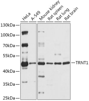 TRNT1 Polyclonal Antibody (E-AB-91872)