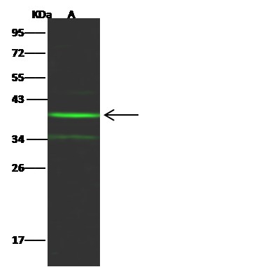 Recombinant NT5C3A/UMPH1 Monoclonal Antibody (AN300444P)