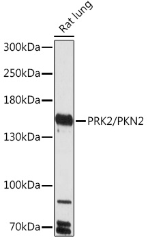 PRK2/PKN2 Polyclonal Antibody (E-AB-92026)