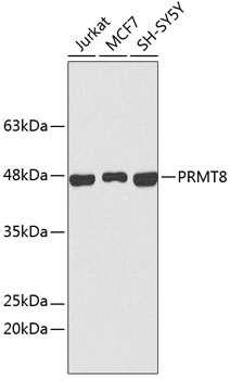 PRMT8 Polyclonal Antibody (E-AB-92471)