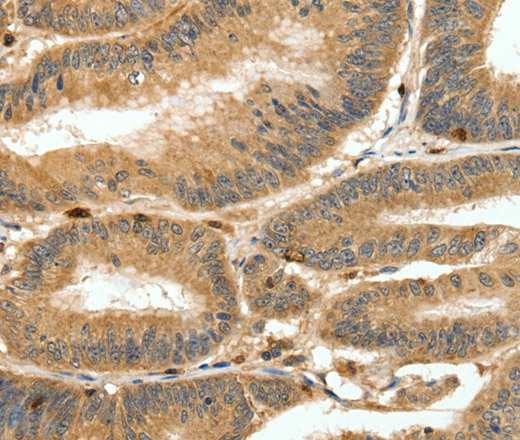 S100A4 Polyclonal Antibody (E-AB-12855)