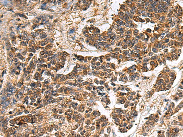 GANAB Polyclonal Antibody (E-AB-53418)