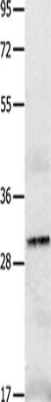 IL2RA Polyclonal Antibody (E-AB-12519)