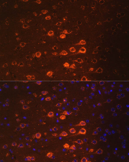NEFM Polyclonal Antibody (E-AB-66803)