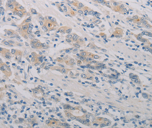 PTAFR Polyclonal Antibody (E-AB-16022)