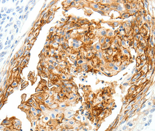 SEMA3D Polyclonal Antibody (E-AB-16058)