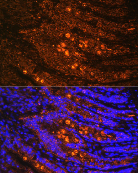 TLN1 Polyclonal Antibody (E-AB-67604)