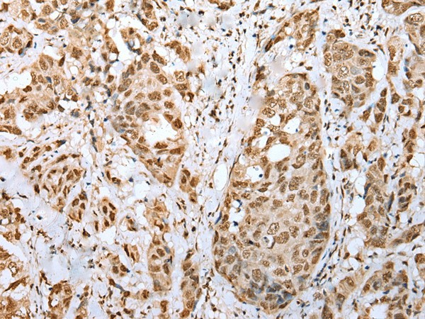 ZNF486 Polyclonal Antibody (E-AB-18362)