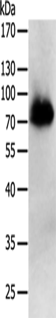 PRMT7 Polyclonal Antibody (E-AB-10554)